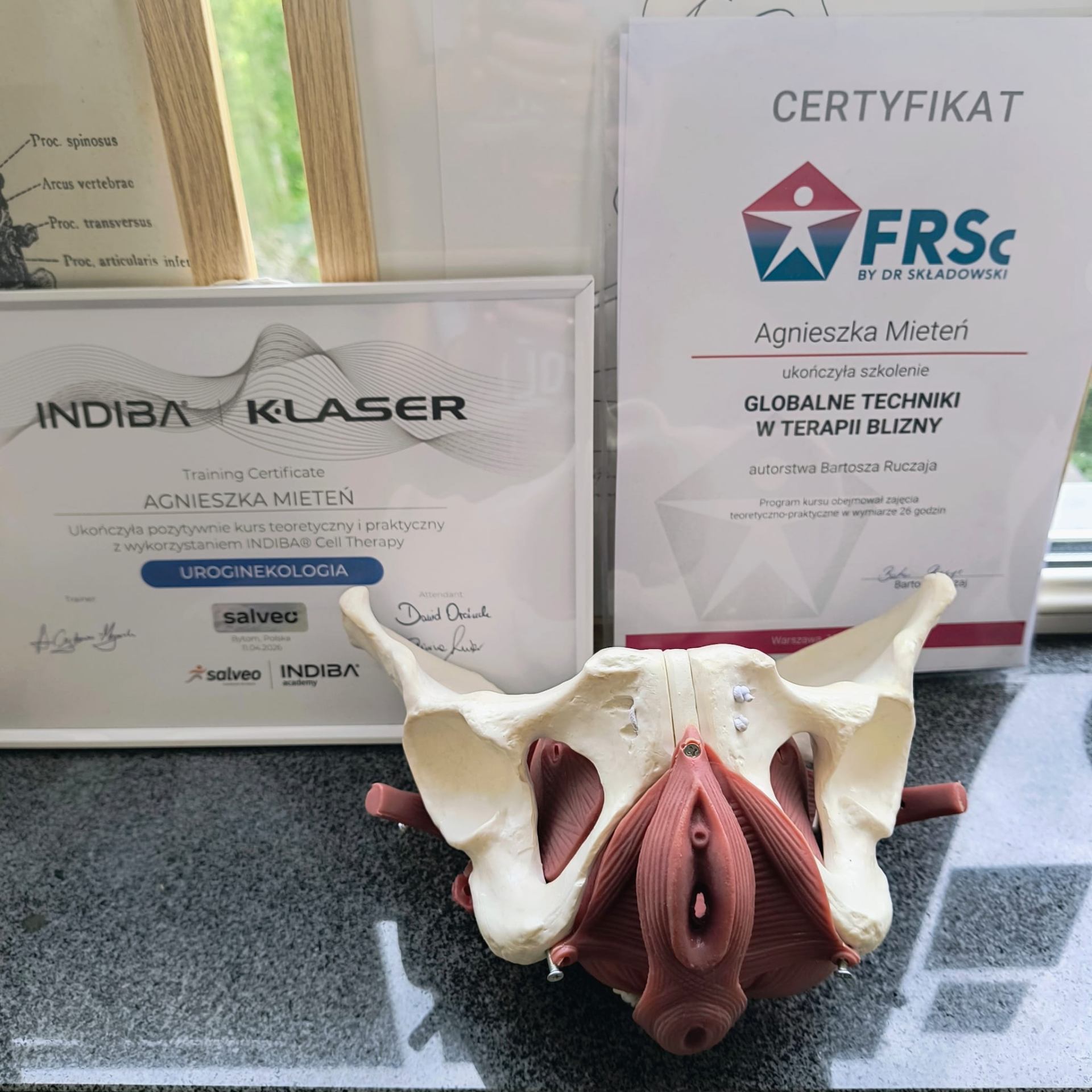 Certyfikaty Agnieszki Mieteń: INDIBA K-Laser Uroginekologia, FRSc Terapia Blizny — model anatomiczny dna miednicy